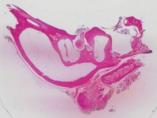 Crista Ampullaris, Mammalian; Section; H&E Stain