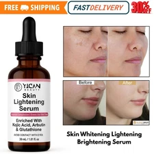 KOJIC ACID Skin Whitening Lightening Brightening Serum Bleaching/Spot Fade Cream