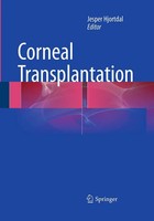 Jesper Hjortdal | Corneal Transplantation | Taschenbuch | Englisch (2016) | Xi