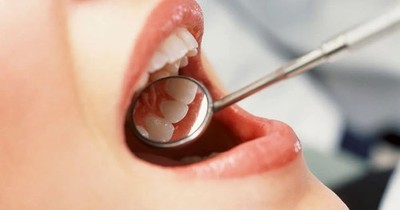 Hahnenkratt SE plus Mouth Mirrors High-reflection, corrosion-resistant mouth