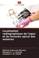 Localisation Radiographique De L'apex Et Du Foramen Apical Des Molaires Buch