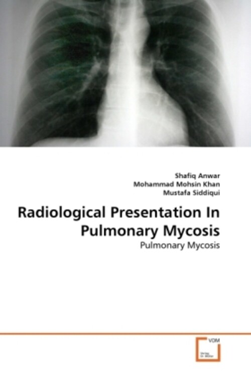 Thumbnail - Shafiq Anwar (u. A.) | Radiological Presentation In Pulmonary Mycosis
