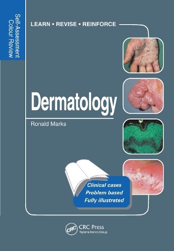 Dermatology by Ronald Marks - 9781840761665