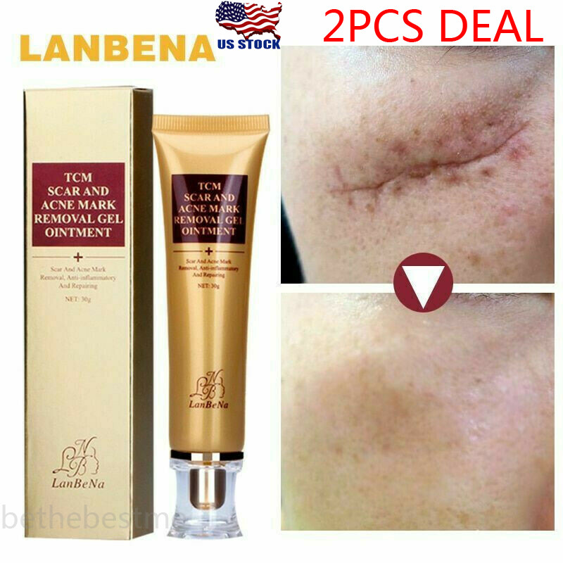 scar cream for dark spots