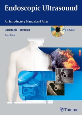 Endoscopic Ultrasound, w. DVD-ROM | An Introductory Manual and Atlas | Dietrich