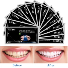 Vakker 28pcs 6% Peroxide Dental Teeth Whitening Strips Bleaching Strips