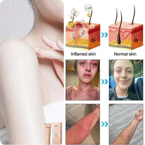 3X Purifying Exfoliating Gel, Quarxery Cleansing Purifying Cream for Face & Body - Bild 5 von 15