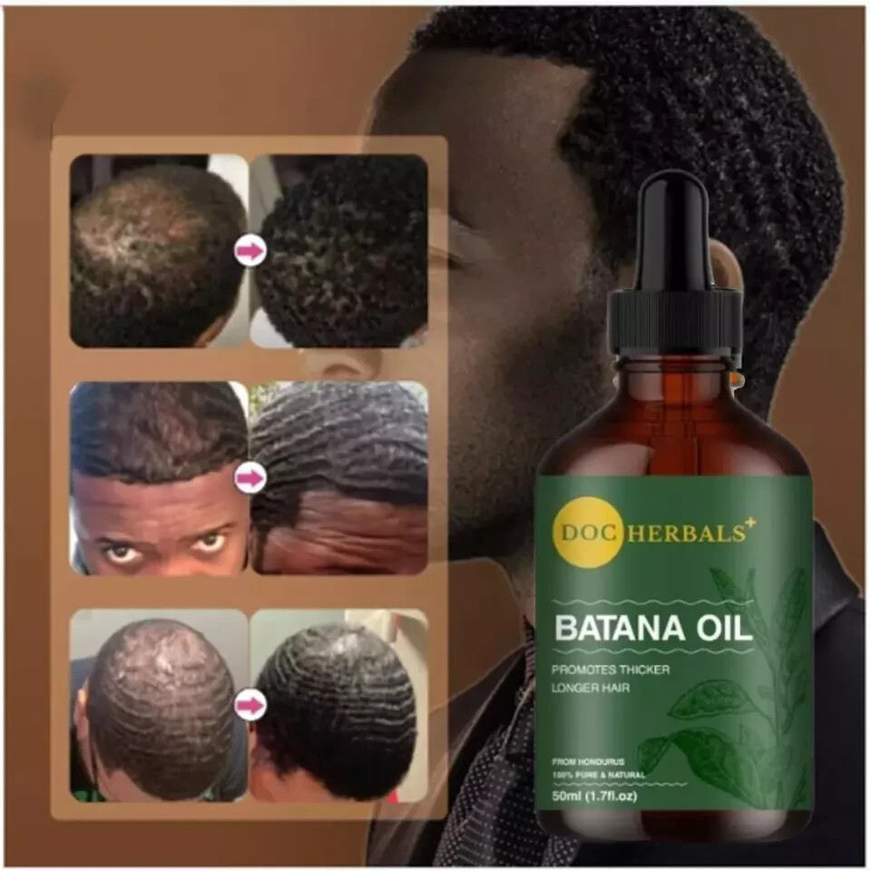 Huile De Botana 100% Pure Dr. Sebi - Pour La Croissance Et Contre La Chute Des Cheveux - 50ml (1.69 Oz)