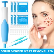 Auto Micro Skin Tag Remover Device Kit Safe Painless Mole Wart Skin Tag Removal