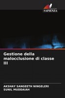 Akshay Sangeeth Ningeleri (U. A.) | Gestione Della Malocclusione Di Classe III