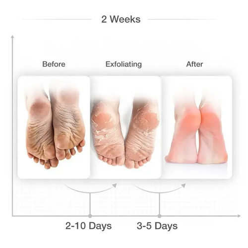 Fußpeeling Maske Pfirsich 2 Paar Peeling harte tote Haut Socken weiche Füße Palmarisa - Bild 4 von 7