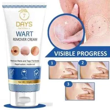 Genital Wart Removal Cream Face, Neck, Forehead & Cheeks. free shipping