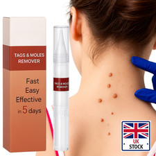 Wart Remover Liquid Skin Tag Mole Remover Eliminate Feet Corn Wart Removal Quick