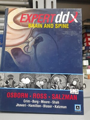 洋書 Expert ddx brain and spine Expertddx (Tm) Ser.: Expert DDX : Brain and Spine by Jeff Ross