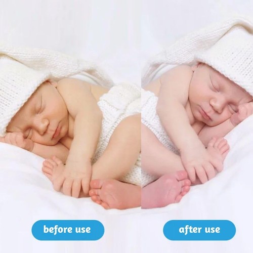 Jaundice Light Therapy Newborn Baby Infant Portable Blue Lamp for Physical Jaund - Picture 6 of 7