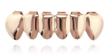 Custom Fit Solid 14K Rose Gold Plated Lower Bottom Teeth Grillz + Molds