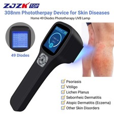 Portable 308nm Light Therapy Device Skin Diseases Treatment UVB Lamp 49 Diodes