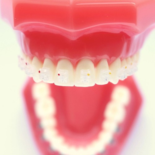 Creative Orthodontic Self Ligating Ceramic Bracket Damon Clear Empower Braces AO - Picture 2 of 56