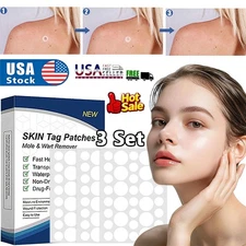 432Pcs Skin Tag Remover Patches Quick Effective Mole Wart Removal Pad Sticker 