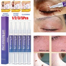 5/3Pack 12 Hours Wart Remover Pen Skin Tag Mole Foot Corn Eliminate Warts Unisex
