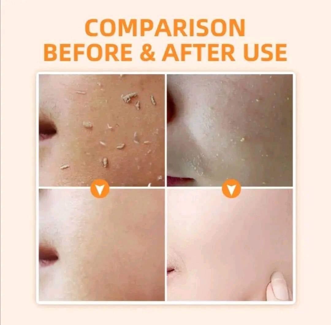 Natürliches Orange Peeling Gel – Tiefenreinigung Fürs Gesicht, Mit Fruchtextrakt, 1 Stück