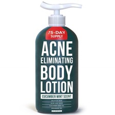 TreeActiv Acne Eliminating Body Lotion 8 fl oz  Clears Body, Back, Butt and ...