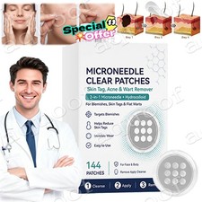 2026 NEW Curalona Microneedle Patches 144pcs, Skin Tag Wart Acne Remover Patches