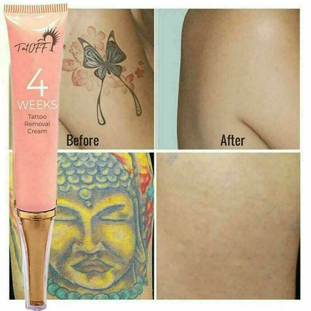 Discover 54+ tattoo eraser cream in.cdgdbentre