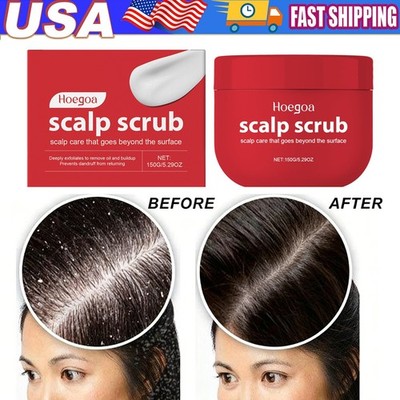 Scalp Scrub,Avocado Oil Scalp Scrub,Rich In Grapefruit Extract,Grapeseed US