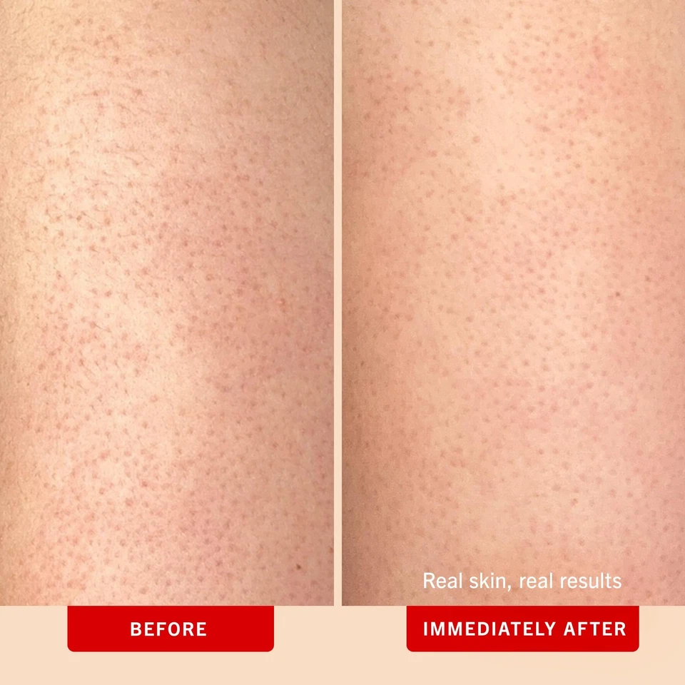 Скраб для тела KP Bump Eraser 10 AHA, отшелушиватель для кератоза пилариса, персик 2 унции - Изображение 3 из 4