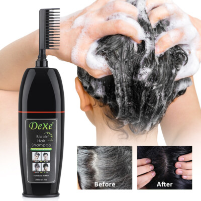 Aazon.co : Hair Dye Shapoo 3 in 1, Dark Brown Hair Dye 16.9 FL Oz