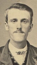 CIVIL WAR ERA CDV. MAN WITH VERY LONG CHIN. ZANESVILLE, OHIO.