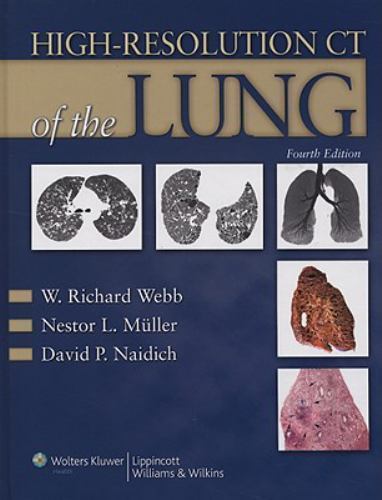 High-Resolution CT of the Lung by Nestor L. Müller, David P