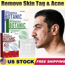 MICRONEEDLE BOTANIC Skin Tag  Acne Patch Skin Tag Remover Patches 9Pcs HOT 2025
