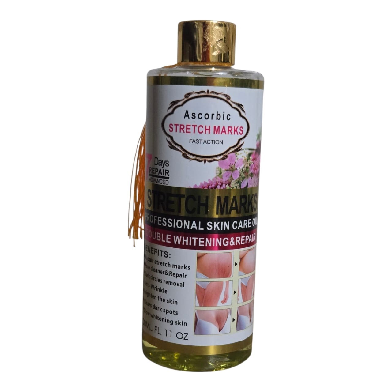 ,body Oil For Scars & Stretch Marks, Oil Hydrates Fades