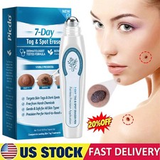 Tag  Spot Eraser Mole Skin Tags Removal Tool Eraser Pen Painless Long-Lasting