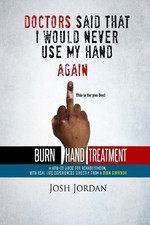 Burn Hand Treatment: A How-To Guide for Rehabilitation with Real Life Experience