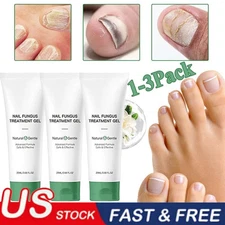1~3PCS Nutraboost Nail Fungus Treatment Gel, Nail Fungus, Fungus Cream 2025 NEW
