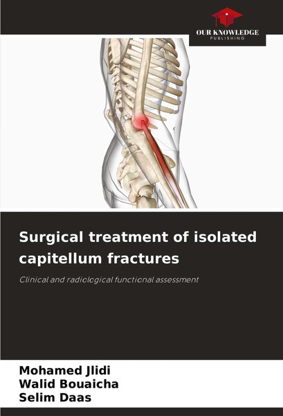 Surgical Treatment Of Isolated Capitellum Fractures Mohamed Jlidi (U. A.) Buch-image