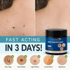 Wart Remover Cream for Men Women 50g 1.76 oz