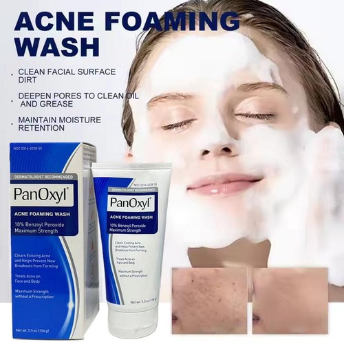 Acne Foaming Wash Face & Body 10% Active ingredient New UK Moisture Sealed Y6B4 - Picture 4 of 12