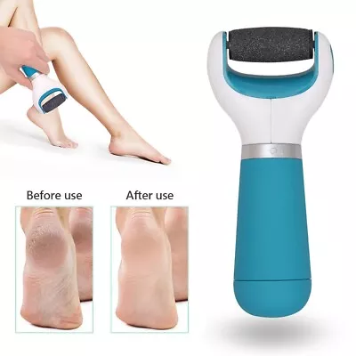Electric Foot Pedicure Roller File Feet Hard Rigid Skin Callus Remover Pedi Tool