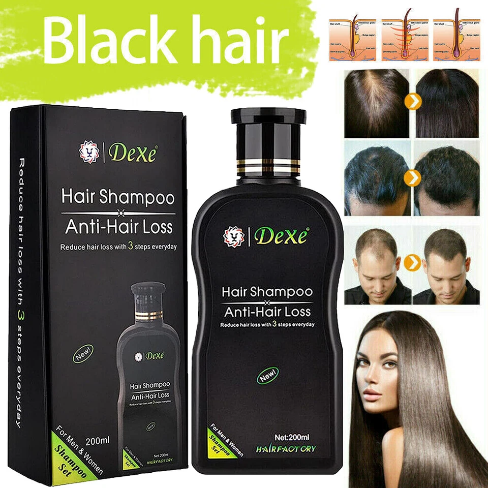 Hair Growth Shampoo Hair Regrowth Treatment Anti-Hair Loss Shampoo For Men&Women - Image 4 of 4