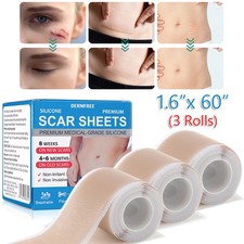3 Roll Scar Removal Silicone Tape Sheets for Hypertrophic Scars Keloids 60"x1.6"