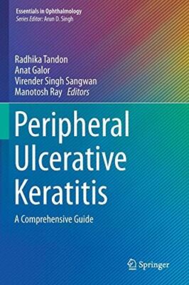 Peripheral Ulcerative Keratitis: A Comprehensive Guide (2017)