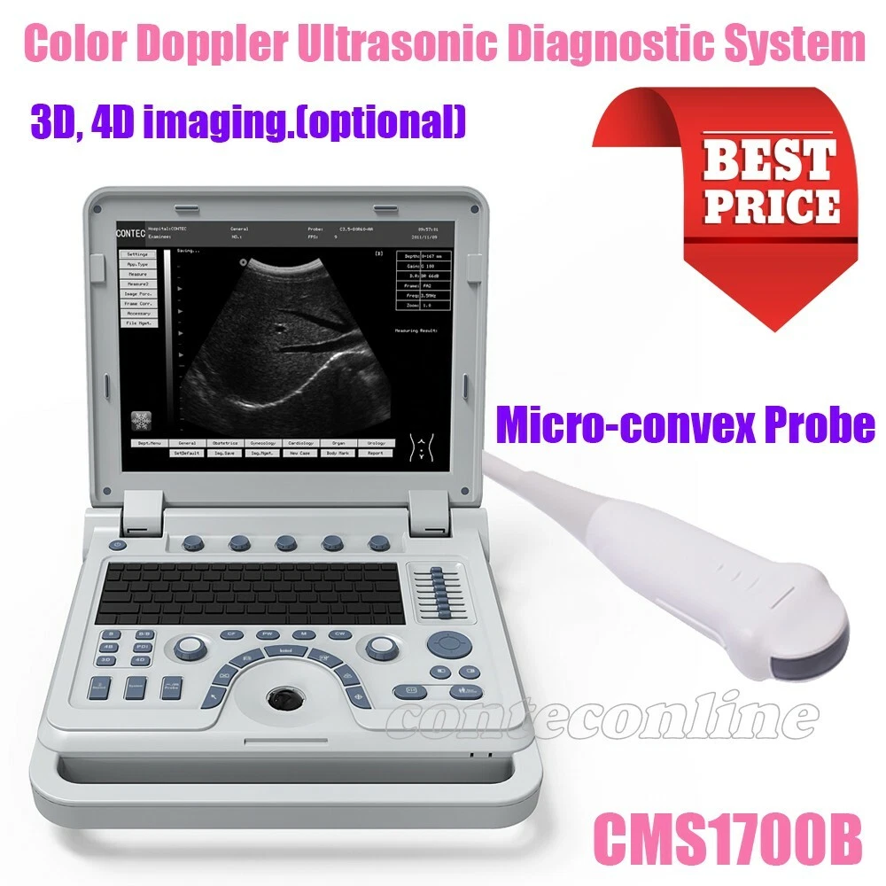 Ultrasonic doppler deals