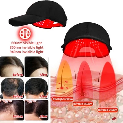 LED Red Light Therapy Hat Hair Loss Treatment Cap Hair Growth 660nm&850nm&940nm