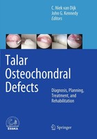 Talar Osteochondral Defects Diagnosis, Planning, Treatment, And Rehabilitation