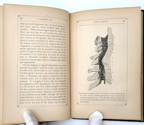 The Life of John Carter 1868 Biography of quadriplegic artist ~Frederick J Mills - Imagen 6 de 8