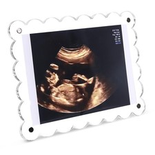 Magnetic Clear Acrylic Scalloped Baby Ultrasound Picture Frame - Sonogram Fra...